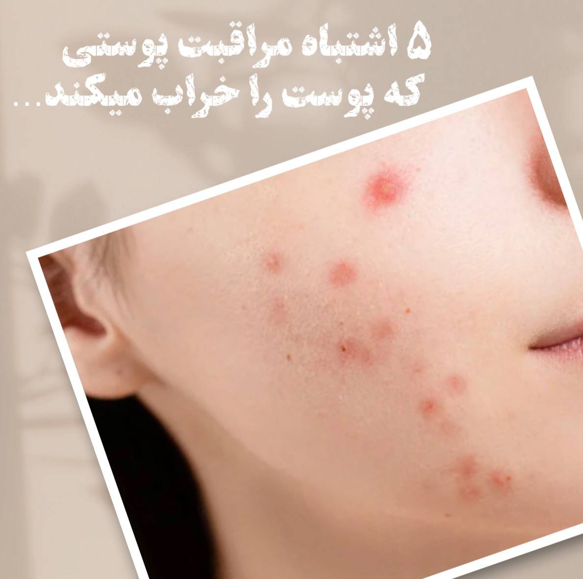 اشتباهات مراقبت پوستی